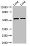 5-hydroxytryptamine receptor 3A antibody, orb48403, Biorbyt, Western Blot image 