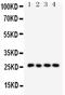 Surfactant Protein A1 antibody, PA5-79986, Invitrogen Antibodies, Western Blot image 