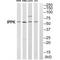 Inositol-Pentakisphosphate 2-Kinase antibody, A11126, Boster Biological Technology, Western Blot image 