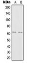 Dehydrogenase/Reductase 7 antibody, orb215184, Biorbyt, Western Blot image 