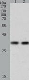 Kim1 antibody, TA322412, Origene, Western Blot image 