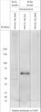 Choline acetyltransferase antibody, NB110-89724, Novus Biologicals, Western Blot image 