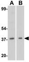 DNA Fragmentation Factor Subunit Beta antibody, GTX31263, GeneTex, Western Blot image 