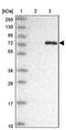 Collagen Beta(1-O)Galactosyltransferase 1 antibody, PA5-61601, Invitrogen Antibodies, Western Blot image 