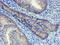 Proteasome Subunit Alpha 6 antibody, LS-C788638, Lifespan Biosciences, Immunohistochemistry paraffin image 
