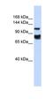 Histone Deacetylase 4 antibody, orb329767, Biorbyt, Western Blot image 