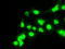 Mitotic checkpoint serine/threonine-protein kinase BUB1 beta antibody, TA500541, Origene, Immunofluorescence image 