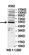 Pancreatic Lipase Related Protein 1 antibody, orb78390, Biorbyt, Western Blot image 