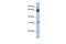 Chromosome 11 Open Reading Frame 54 antibody, GTX47139, GeneTex, Western Blot image 