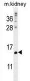 MORN Repeat Containing 5 antibody, AP52731PU-N, Origene, Western Blot image 