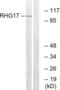 Rho GTPase-activating protein 17 antibody, abx014818, Abbexa, Western Blot image 