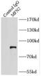 Mitofusin 2 antibody, FNab05151, FineTest, Immunoprecipitation image 