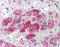 Calmodulin antibody, 48-075, ProSci, Immunohistochemistry paraffin image 