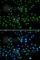 N-Acetyltransferase 10 antibody, A7292, ABclonal Technology, Immunofluorescence image 