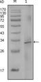 Coagulation Factor VIII antibody, M00367, Boster Biological Technology, Western Blot image 