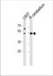 Solute Carrier Family 25 Member 25 antibody, TA328159, Origene, Western Blot image 
