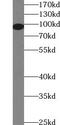 Dual specificity protein kinase TTK antibody, FNab09094, FineTest, Western Blot image 