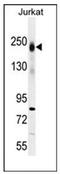 Lca antibody, AP53512PU-N, Origene, Western Blot image 