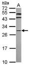 Homeobox C8 antibody, GTX103993, GeneTex, Western Blot image 