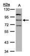 Arachidonate Lipoxygenase 3 antibody, NBP1-32533, Novus Biologicals, Western Blot image 