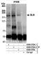 BLM RecQ Like Helicase antibody, A300-572A, Bethyl Labs, Immunoprecipitation image 