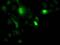 Uridine-cytidine kinase 1 antibody, GTX83446, GeneTex, Immunocytochemistry image 
