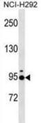 Janus Kinase And Microtubule Interacting Protein 2 antibody, abx030837, Abbexa, Western Blot image 