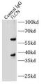 Folliculin antibody, FNab03157, FineTest, Immunoprecipitation image 