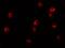 Lysine Demethylase 6B antibody, GTX31466, GeneTex, Immunofluorescence image 