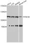 cGMP-inhibited 3 ,5 -cyclic phosphodiesterase B antibody, STJ110746, St John