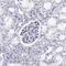 ETV6 antibody, HPA000264, Atlas Antibodies, Immunohistochemistry paraffin image 