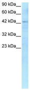 Recombination Signal Binding Protein For Immunoglobulin Kappa J Region antibody, TA329209, Origene, Western Blot image 