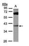 Dual Specificity Phosphatase 7 antibody, GTX109289, GeneTex, Western Blot image 