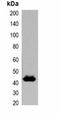 Glutathione-S-Transferase Tag antibody, orb323076, Biorbyt, Western Blot image 