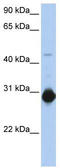 Ras Homolog Family Member U antibody, TA344077, Origene, Western Blot image 