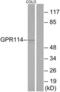 Adhesion G Protein-Coupled Receptor G5 antibody, LS-C120677, Lifespan Biosciences, Western Blot image 
