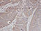 CDC42 Binding Protein Kinase Alpha antibody, LS-C185496, Lifespan Biosciences, Immunohistochemistry frozen image 