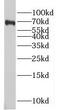 Melanoma-associated antigen D2 antibody, FNab04948, FineTest, Western Blot image 