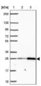 Solute Carrier Family 22 Member 18 Antisense antibody, NBP2-39093, Novus Biologicals, Western Blot image 
