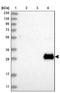 Fibroblast growth factor receptor 2 antibody, NBP1-88670, Novus Biologicals, Western Blot image 