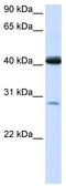 Glutaryl-CoA Dehydrogenase antibody, TA332368, Origene, Western Blot image 