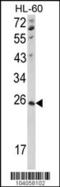 NME/NM23 Nucleoside Diphosphate Kinase 4 antibody, 63-432, ProSci, Western Blot image 