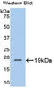 Metallothionein 2A antibody, LS-C305396, Lifespan Biosciences, Western Blot image 