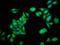Zinc Finger Protein 703 antibody, LS-C674136, Lifespan Biosciences, Immunofluorescence image 