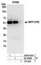 Membrane Palmitoylated Protein 1 antibody, A304-431A, Bethyl Labs, Immunoprecipitation image 