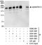 ADAMTS13 antibody, A301-000A, Bethyl Labs, Immunoprecipitation image 