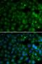 4-Hydroxyphenylpyruvate Dioxygenase antibody, LS-C334758, Lifespan Biosciences, Immunofluorescence image 