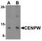 Centromere Protein W antibody, TA320184, Origene, Western Blot image 