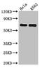 Sorting Nexin 9 antibody, CSB-PA896917LA01HU, Cusabio, Western Blot image 