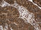 SERPINE1 MRNA Binding Protein 1 antibody, LS-C175440, Lifespan Biosciences, Immunohistochemistry paraffin image 